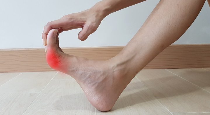 bütyök, lábproblémák, reumatológia,