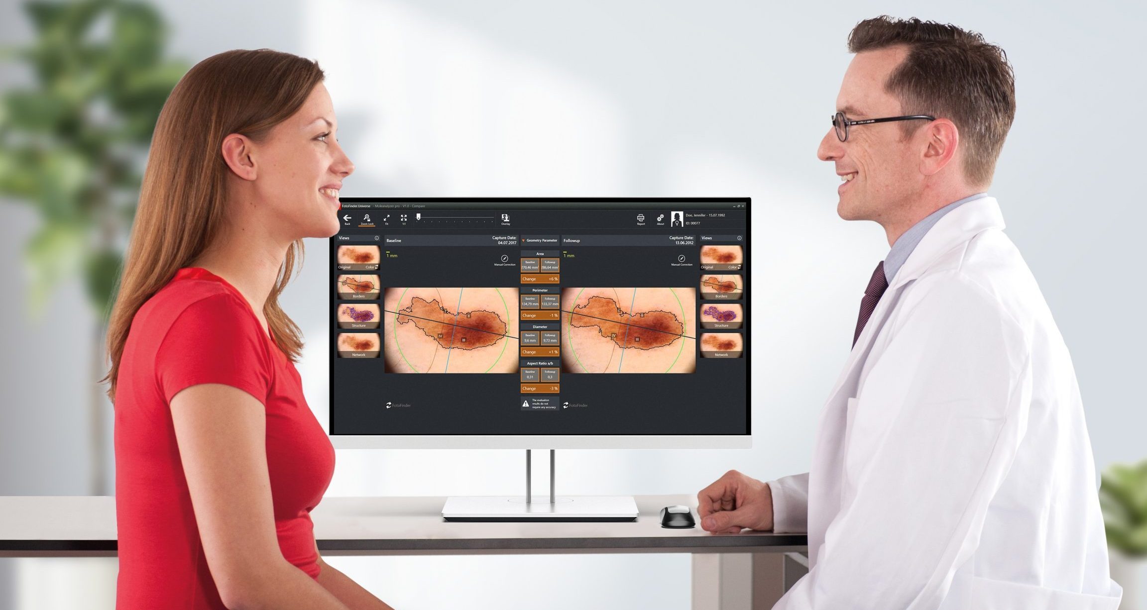 anyajegy, konzultáció, bőrgyógyász